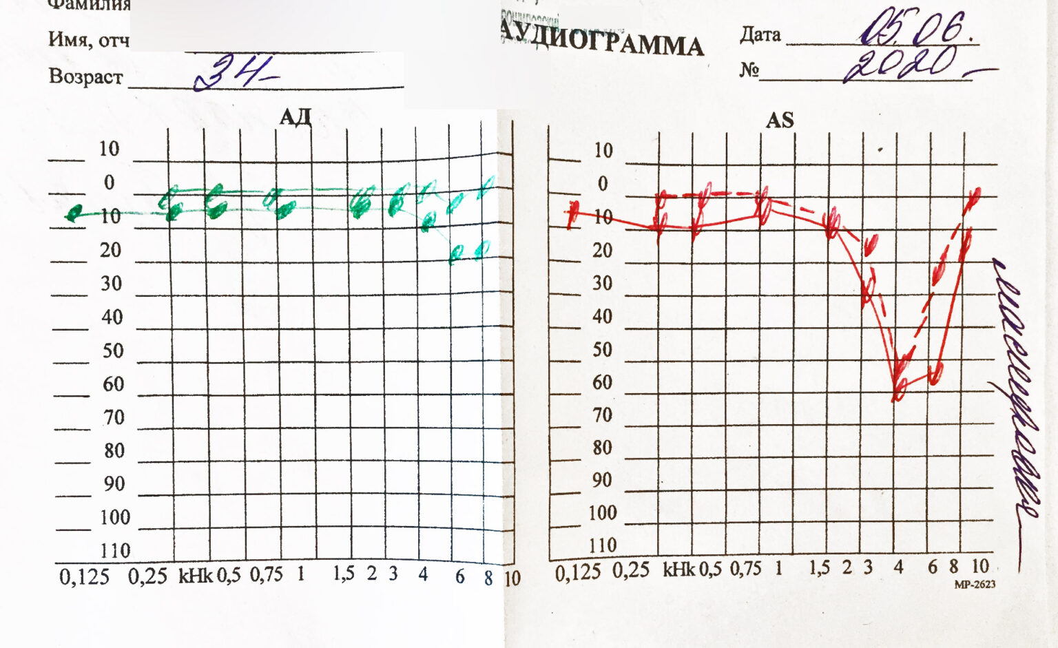 Аудиограмма это