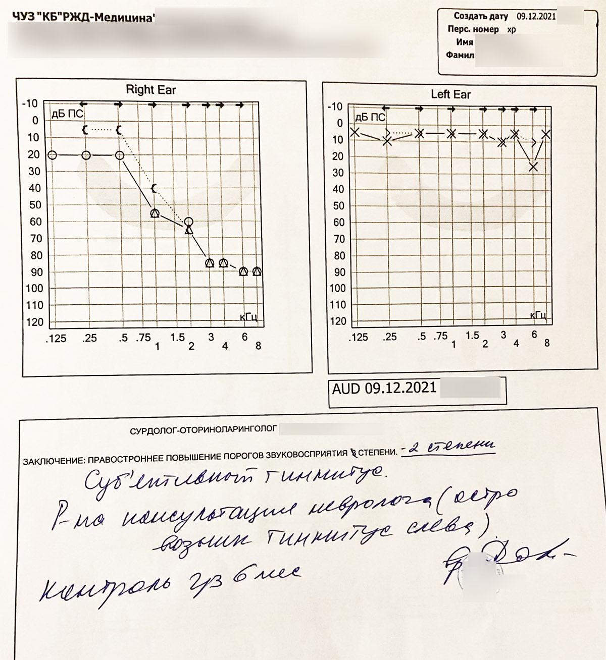 Одностороннее явное падение слуха и шум по пути. Рекомендация со слухом №89  – Борис Симкин